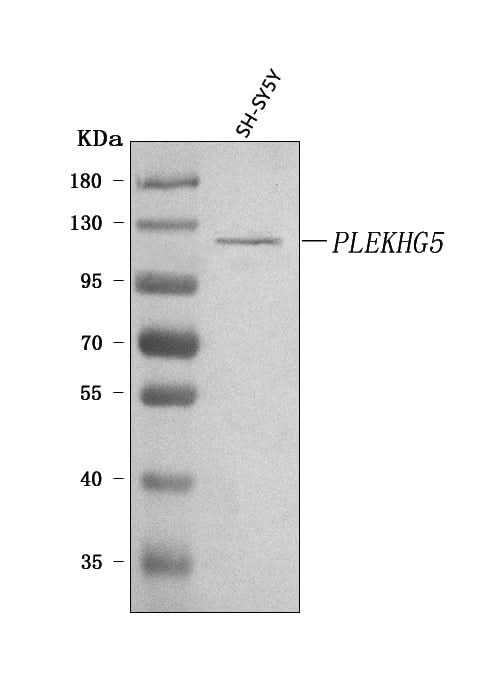 Anti-PLEKHG5 Antibody Picoband® Boster Bio