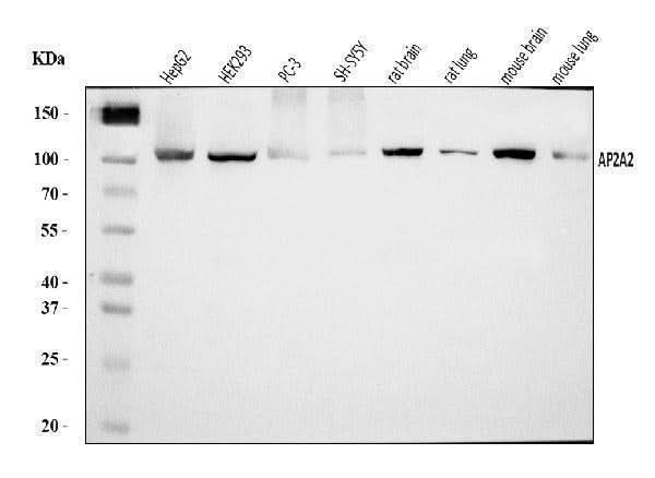 Anti-AP2A2 Antibody Picoband® Boster Bio