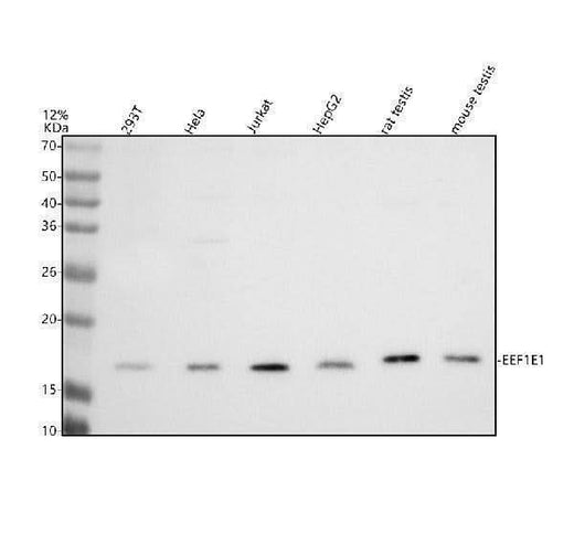 Anti-EIF5B Antibody Picoband® Boster Bio