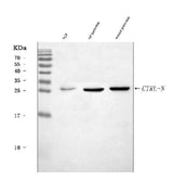 Anti-CTRL Antibody Picoband® Boster Bio