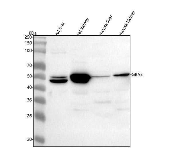 Anti-GBA3 Antibody Picoband® Boster Bio