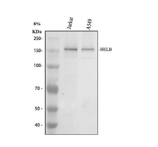 Anti-HELB Antibody Picoband® Boster Bio