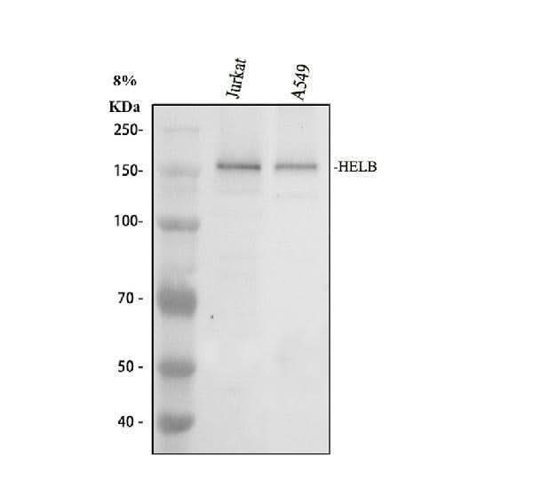 Anti-HELB Antibody Picoband® Boster Bio