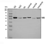 Anti-YARS1 Antibody Picoband® Boster Bio