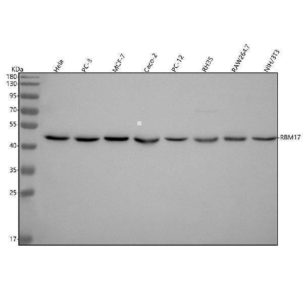 Anti-RBM17 Antibody Picoband® Boster Bio