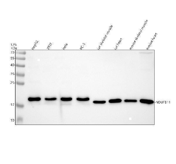 Anti-NDUFB11 Antibody Picoband® Boster Bio
