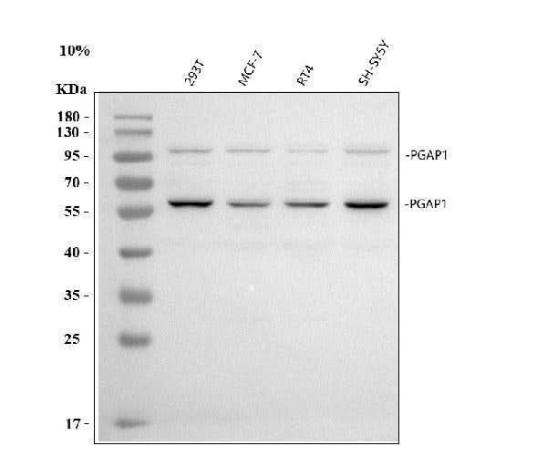 Anti-PGAP1 Antibody Picoband® Boster Bio