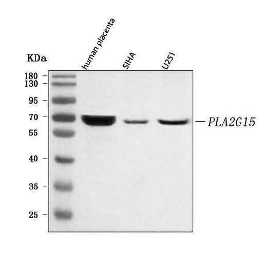 Anti-LYPLA3/PLA2G15 Antibody Picoband® Boster Bio