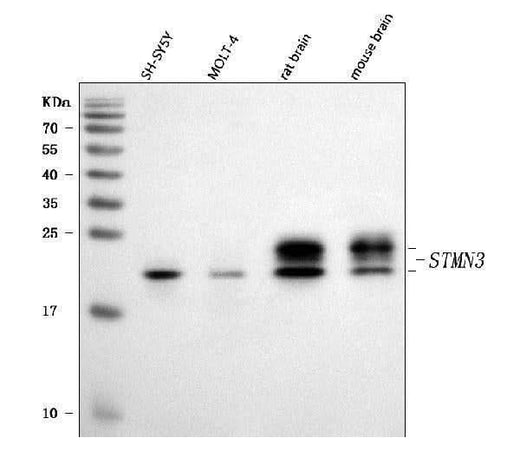Anti-STMN3 Antibody Picoband® Boster Bio