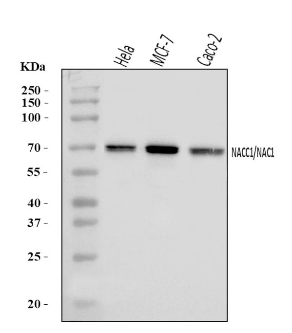 Anti-Nac1/NACC1 Antibody Picoband® Boster Bio