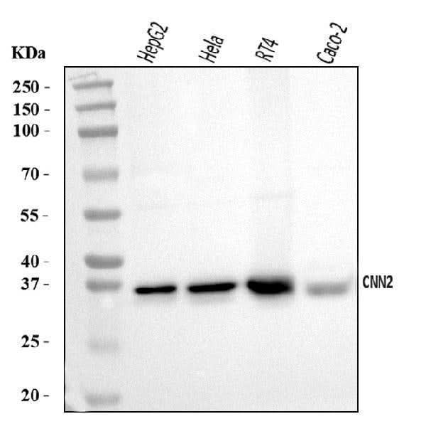 Anti-Calponin 2/CNN2 Antibody Picoband® Boster Bio