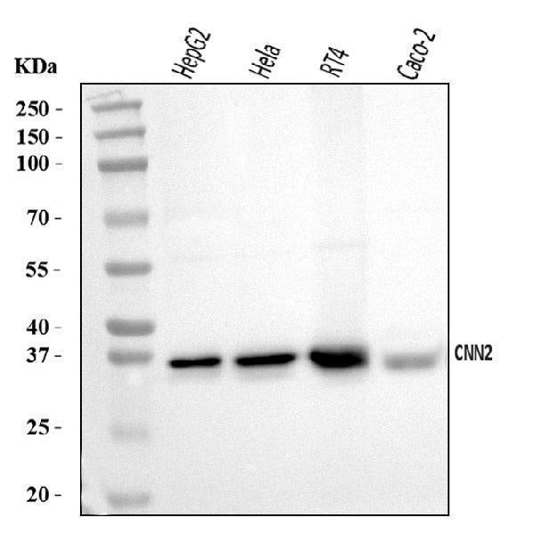 Anti-Calponin 2/CNN2 Antibody Picoband® Boster Bio
