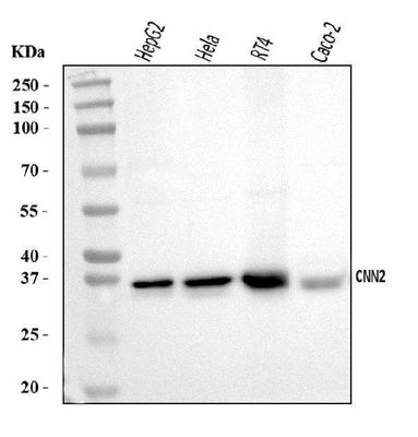 Anti-Calponin 2/CNN2 Antibody Picoband® Boster Bio