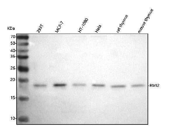 Anti-C16orf75/RMI2 Antibody Picoband® Boster Bio