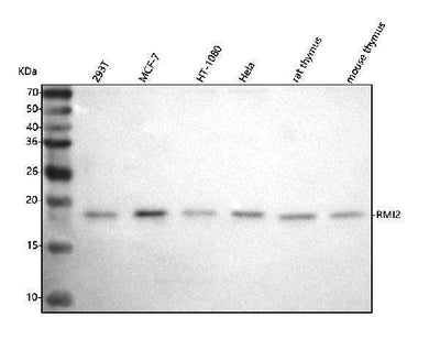 Anti-C16orf75/RMI2 Antibody Picoband® Boster Bio
