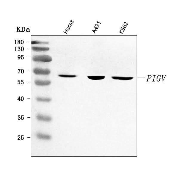Anti-PIGV Antibody Picoband® Boster Bio