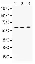 Anti-Hydrogen Potassium ATPase Beta/ATP4B Antibody Picoband® Boster Bio