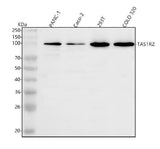 Anti-TAS1R2 Antibody Picoband® Boster Bio