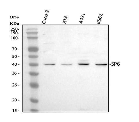 Anti-SP6 Antibody Picoband® Boster Bio