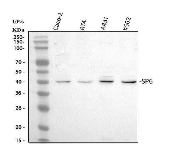 Anti-SP6 Antibody Picoband® Boster Bio