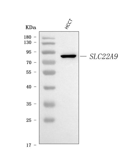 Anti-SLC22A9 Antibody Picoband® Boster Bio