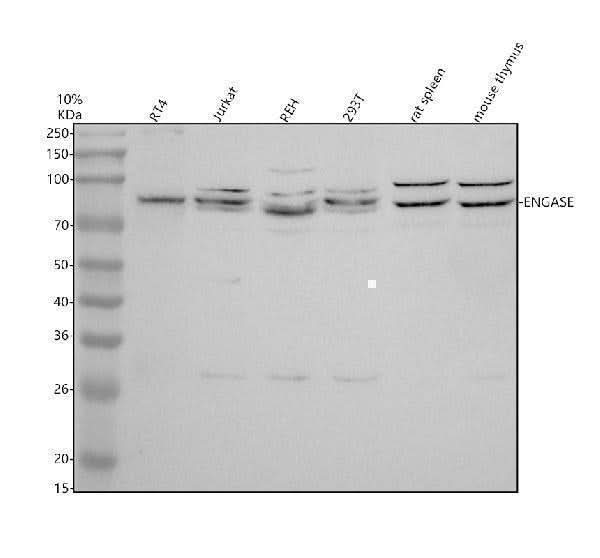 Anti-ELAC2 Antibody Picoband® Boster Bio