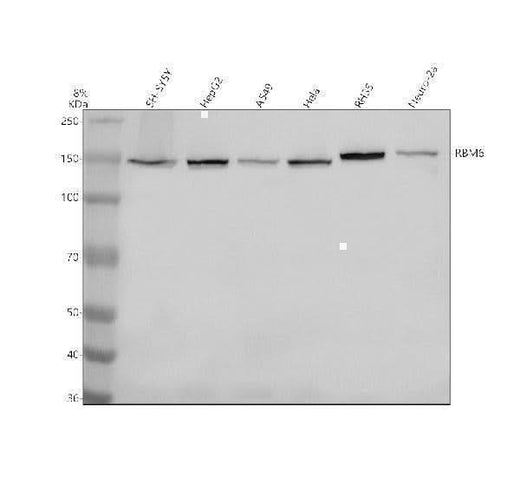 Anti-RBM6 Antibody Picoband® Boster Bio
