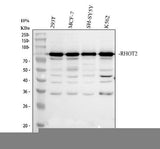 Anti-MIRO2/RHOT2 Antibody Picoband® Boster Bio