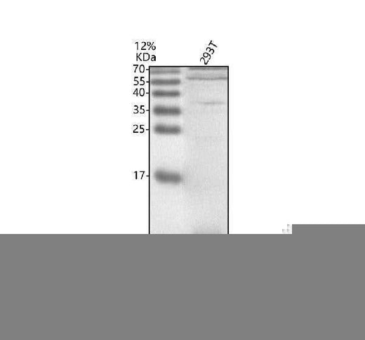 Anti-SNRPG Antibody Picoband® Boster Bio