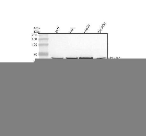 Anti-SPOCK2 Antibody Picoband® Boster Bio