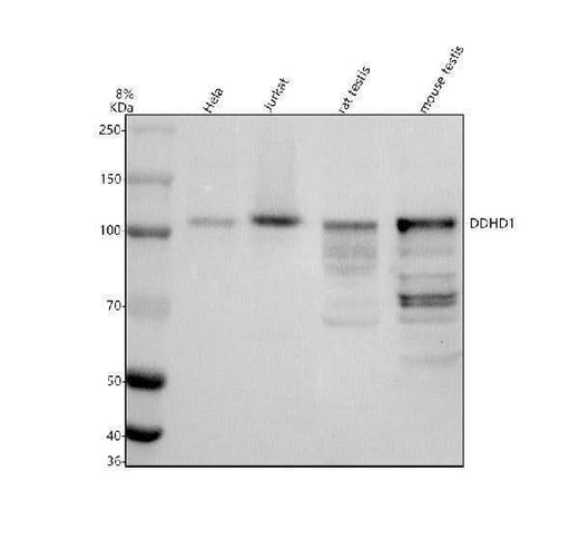 Anti-DDHD1 Antibody Picoband® Boster Bio