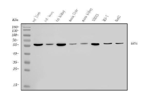 Anti-ALDH6A1 Antibody Picoband® Boster Bio