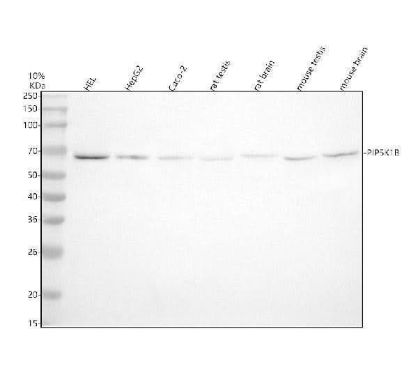 Anti-PIP5K1B Antibody Picoband® Boster Bio