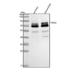 Anti-TRIM2 Antibody Picoband® Boster Bio
