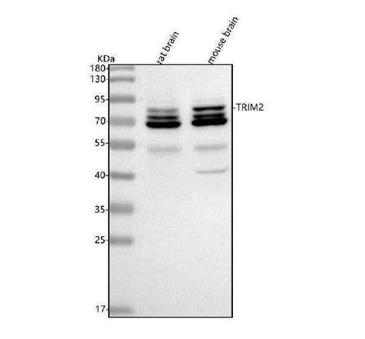 Anti-TRIM2 Antibody Picoband® Boster Bio