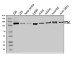 Anti-PITRM1 Antibody Picoband® Boster Bio