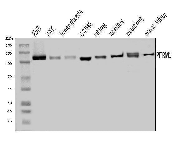 Anti-PITRM1 Antibody Picoband® Boster Bio