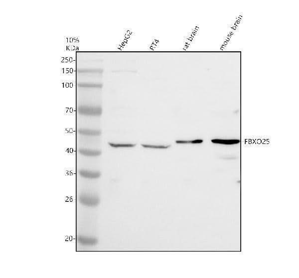 Anti-FBXO25 Antibody Picoband® Boster Bio