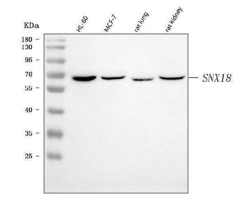 Anti-SNX18 Antibody Picoband® Boster Bio