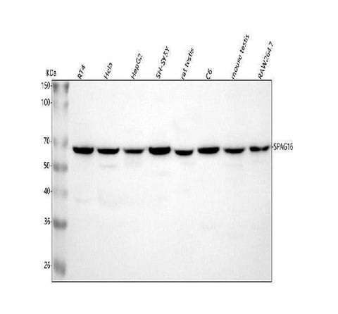 Anti-SPAG16 Antibody Picoband® Boster Bio