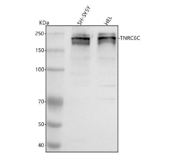 Anti-TNRC6C Antibody Picoband® Boster Bio