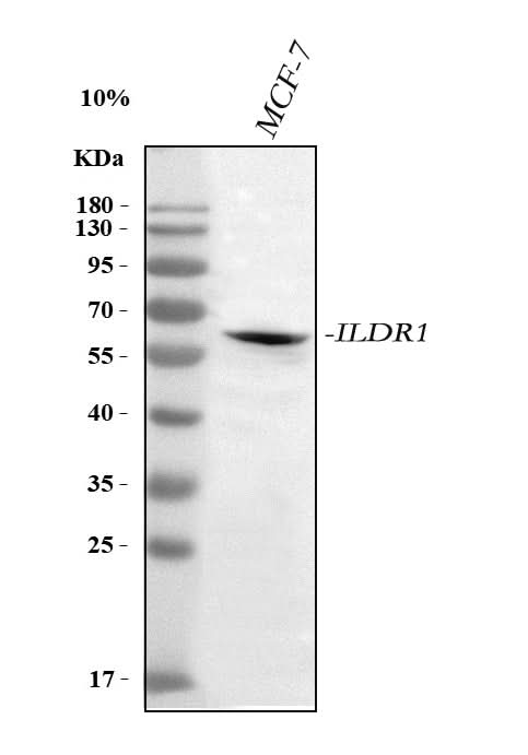 Anti-ILDR1 Antibody Picoband® Boster Bio