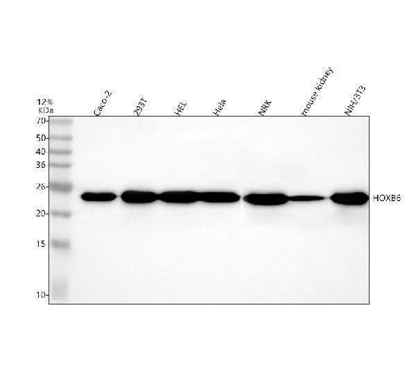 Anti-HOXB6 Antibody Picoband® Boster Bio