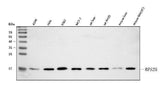 Anti-RPS25 Antibody Picoband® Boster Bio