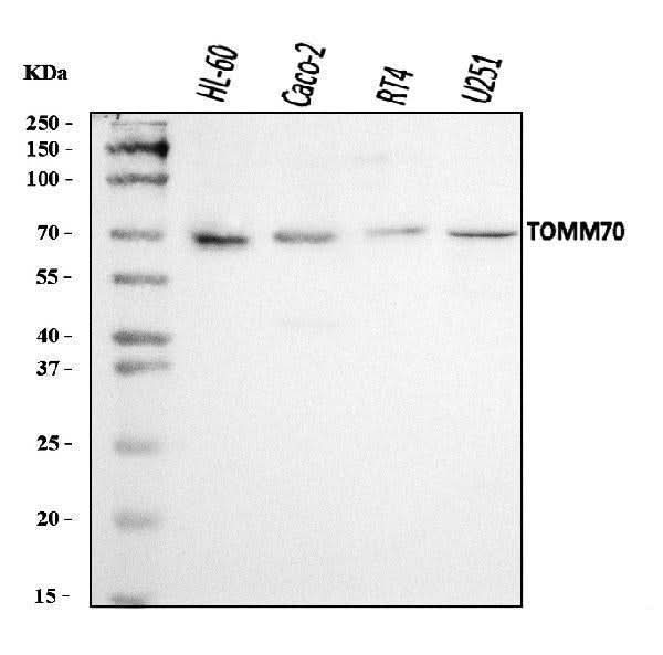Anti-TOMM70 Antibody Picoband® Boster Bio