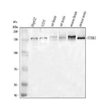 Anti-TTBK1 Antibody Picoband® Boster Bio
