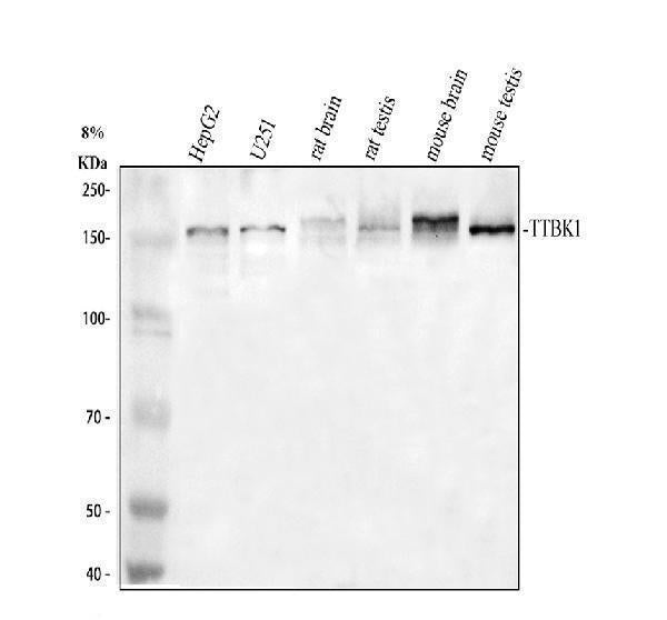 Anti-TTBK1 Antibody Picoband® Boster Bio