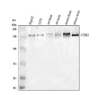Anti-TTBK1 Antibody Picoband® Boster Bio
