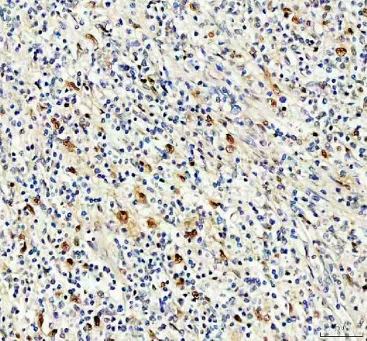 Anti-NKX2-3 Antibody Boster Bio