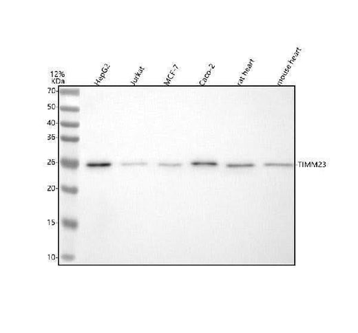 Anti-TIM23/TIMM23 Antibody Picoband® Boster Bio